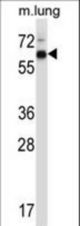 Mouse Mknk2 Antibody western blot of mouse lung tissue lysates (35 ug/lane). The Mknk2 antibody detected the Mknk2 protein (arrow).