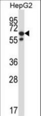PPM1G Antibody western blot of HepG2 cell line lysates (35 ug/lane). The PPM1G antibody detected the PPM1G protein (arrow).