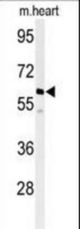 Western blot of hPPM1G-C164 in mouse heart tissue lysates (35 ug/lane). PPM1G (arrow) was detected using the purified antibody.