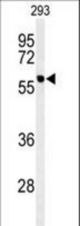Western blot of hPPM1G-C164 in 293 cell line lysates (35 ug/lane). PPM1G (arrow) was detected using the purified antibody.