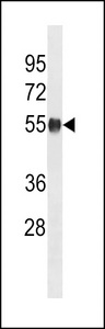 MOUSE Ppm1h Antibody western blot of mouse cerebellum tissue lysates (35 ug/lane). The MOUSE Ppm1h antibody detected the MOUSE Ppm1h protein (arrow).