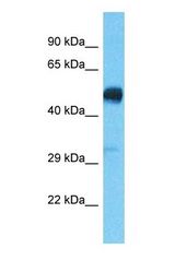 Western blot of PPM1H Antibody with human 293T Whole Cell lysate.