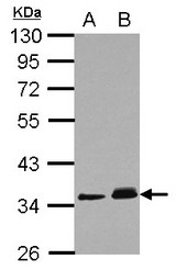 Sample (30 ug of whole cell lysate) A: A431 B: HeLa 10% SDS PAGE PPM1J antibody diluted at 1:1000