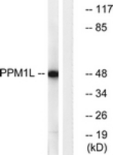 Western blot of extracts from Jurkat cells, using PPM1L Antibody. The lane on the right is treated with the synthesized peptide.