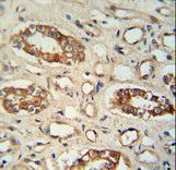 PPM1L antibody immunohistochemistry of formalin-fixed and paraffin-embedded human lung tissue followed by peroxidase-conjugated secondary antibody and DAB staining.