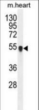 PPM1L Antibody western blot of mouse heart tissue lysates (35 ug/lane). The PPM1L antibody detected the PPM1L protein (arrow).