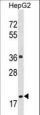 PPM1M Antibody western blot of HepG2 cell line lysates (35 ug/lane). The PPM1M antibody detected the PPM1M protein (arrow).
