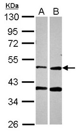 Sample (30 ug of whole cell lysate) A: A549 B: HCT116 10% SDS PAGE PPOX antibody diluted at 1:2000