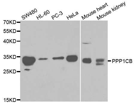 Western blot analysis of extracts of various cell lines, using PPP1CB antibody.