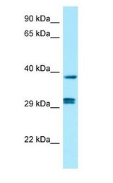 PPP1CB antibody Western Blot of Fetal Kidney.