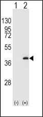 Western blot of PPP1CB (arrow) using rabbit polyclonal PPP1CB Antibody (K301). 293 cell lysates (2 ug/lane) either nontransfected (Lane 1) or transiently transfected (Lane 2) with the PPP1CB gene.
