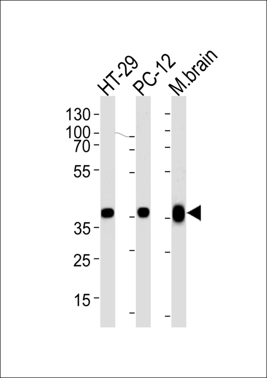 Western blot of lysates from HT-29, PC-12 cell line and mouse brain tissue lysate (from left to right), using PPP1CB Antibody. Antibody was diluted at 1:1000 at each lane. A goat anti-rabbit IgG H&L (HRP) at 1:5000 dilution was used as the secondary antibody. Lysate at 35ug per lane.