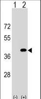 Western blot of PPP1CC (arrow) using rabbit polyclonal PPP1CC Antibody. 293 cell lysates (2 ug/lane) either nontransfected (Lane 1) or transiently transfected (Lane 2) with the PPP1CC gene.