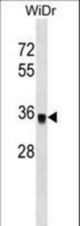 PPP1CC Antibody western blot of WiDr cell line lysates (35 ug/lane). The PPP1CC antibody detected the PPP1CC protein (arrow).