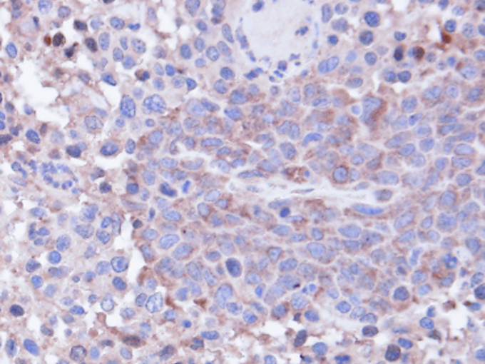IHC of paraffin-embedded SAS xenograft using PPP1CC antibody at 1:100 dilution.