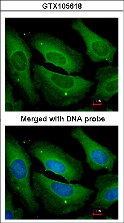 Immunofluorescence of paraformaldehyde-fixed HeLa using PP1 gamma antibody at 1:200 dilution.