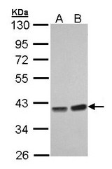 Sample (30 ug of whole cell lysate). A: Hep G2 , B: Molt-4 . 10% SDS PAGE. PP1 gamma / PPP1CC antibody diluted at 1:1000