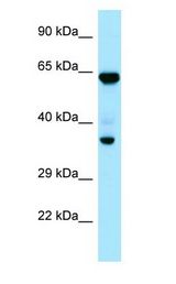 PPP1CC / PP1 Gamma antibody Western Blot of HeLa.
