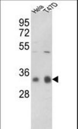 Western blot of hPPP1CC-A306 in HeLa, T47D cell line lysates (35 ug/lane). PPP1CC (arrow) was detected using the purified antibody.