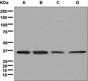 Western blot analysis on (A) T47-D, (B) 293T, (C) SKBR-3, and (D) HeLa cell lysates using anti-PPP1CC antibody.