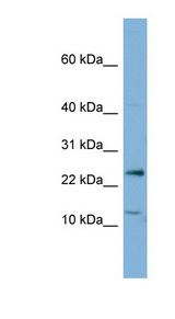 PPP1R11 antibody LS-C107646 Western blot of OVCAR-3 cell lysate.