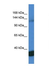 PPP1R12A / MYPT1 antibody LS-C135930 Western blot of Jurkat Cell lysate. Antibody concentration 1 ug/ml.