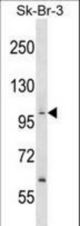 PPP1R13B Antibody western blot of SK-BR-3 cell line lysates (35 ug/lane). The PPP1R13B antibody detected the PPP1R13B protein (arrow).