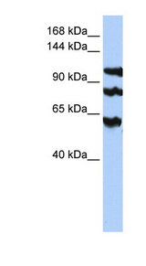 PPP1R13B antibody LS-C102276 Western blot of HepG2 cell lysate.