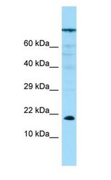 PPP1R14A / CPI-17 antibody Western Blot of PANC1.