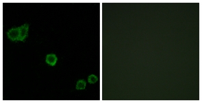 Immunofluorescence of HeLa cells, using CPI17 alpha (Ab-38) Antibody. The picture on the right is treated with the synthesized peptide.