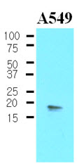The Cell lysates of A549 (30 ug) were resolved by SDS-PAGE, transferred to NC membrane and probed with anti-human PPP1R14A (1:500). Proteins were visualized using a goat anti-mouse secondary antibody conjugated to HRP and an ECL detection system.
