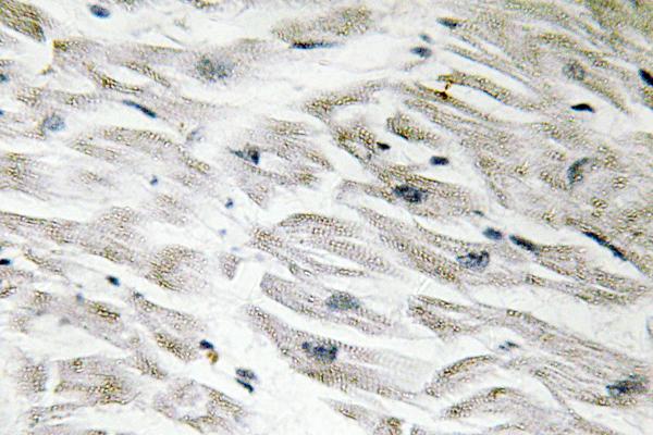 IHC of CPI-17 (K32) pAb in paraffin-embedded human heart tissue.