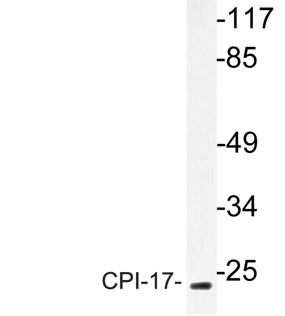 Western blot of CPI-17 (K32) pAb in extracts from HT-29 cells.