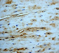 IHC of paraffin-embedded human normal aorta using anti-CPI- 17 alpha antibody.