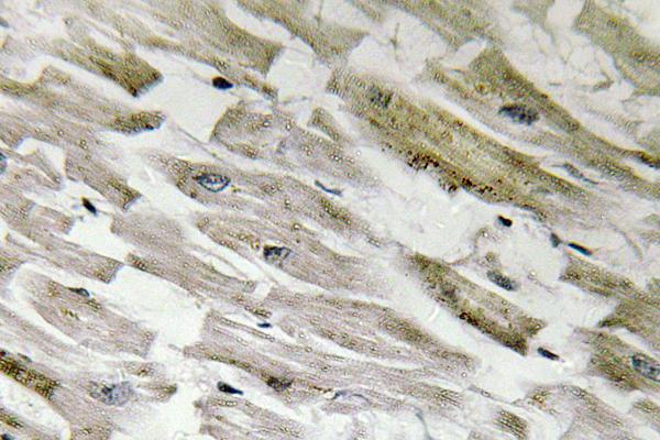 IHC of p-CPI-17 (T38) pAb in paraffin-embedded human heart tissue.