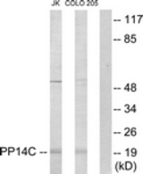 Western blot of extracts from Jurkat/COLO205 cells, using PPP1R14C Antibody. The lane on the right is treated with the synthesized peptide.