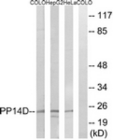 Western blot of extracts from HeLa/HepG2/COLO cells, using PPP1R14D Antibody. The lane on the right is treated with the synthesized peptide.