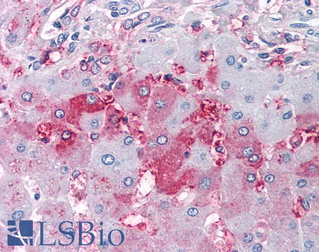 Anti-DUSP26 antibody LS-A6784 IHC of human liver. Immunohistochemistry of formalin-fixed, paraffin-embedded tissue after heat-induced antigen retrieval.