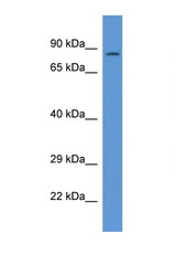 PPP1R15B antibody LS-C135852 Western blot of 1 Cell lysate. Antibody concentration 1 ug/ml.