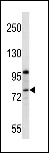 PR15B Antibody western blot of MCF-7 cell line lysates (35 ug/lane). The PR15B antibody detected the PR15B protein (arrow).