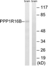 Western blot of extracts from mouse brain cells, using PPP1R16B Antibody. The lane on the right is treated with the synthesized peptide.