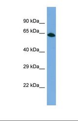 Western blot of Human HepG2. PPP1R18 antibody dilution 1.0 ug/ml.