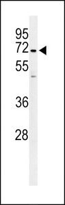 Western blot of PHTNS Antibody in Ramos cell line lysates (35 ug/lane). PHTNS (arrow) was detected using the purified antibody.