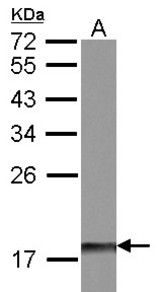 Sample (30 ug of whole cell lysate). A: IMR32. 12% SDS PAGE. MKP-8 / DUSP26 antibody diluted at 1:500.