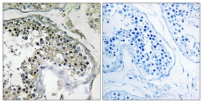 IHC of paraffin-embedded human testis tissue, using PPP1R1C Antibody. The sample on the right was incubated with synthetic peptide.