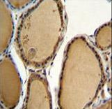 KLRAQ1 Antibody immunohistochemistry of formalin-fixed and paraffin-embedded human thyroid tissue followed by peroxidase-conjugated secondary antibody and DAB staining.