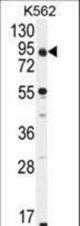 KLRAQ1 Antibody western blot of K562 cell line lysates (35 ug/lane). The KLRAQ1 antibody detected the KLRAQ1 protein (arrow).