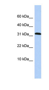 DYSFIP1 antibody LS-C111332 Western blot of HepG2 cell lysate.