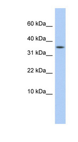 DYSFIP1 antibody LS-C111333 Western blot of HepG2 cell lysate.