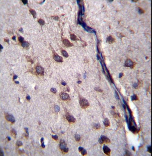 DYSFIP1 Antibody immunohistochemistry of formalin-fixed and paraffin-embedded human brain tissue followed by peroxidase-conjugated secondary antibody and DAB staining.